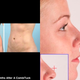 Illustration for article titled This iPhone Plastic Surgery App Shows You How Ugly You'll Be Once You Get Plastic Surgery